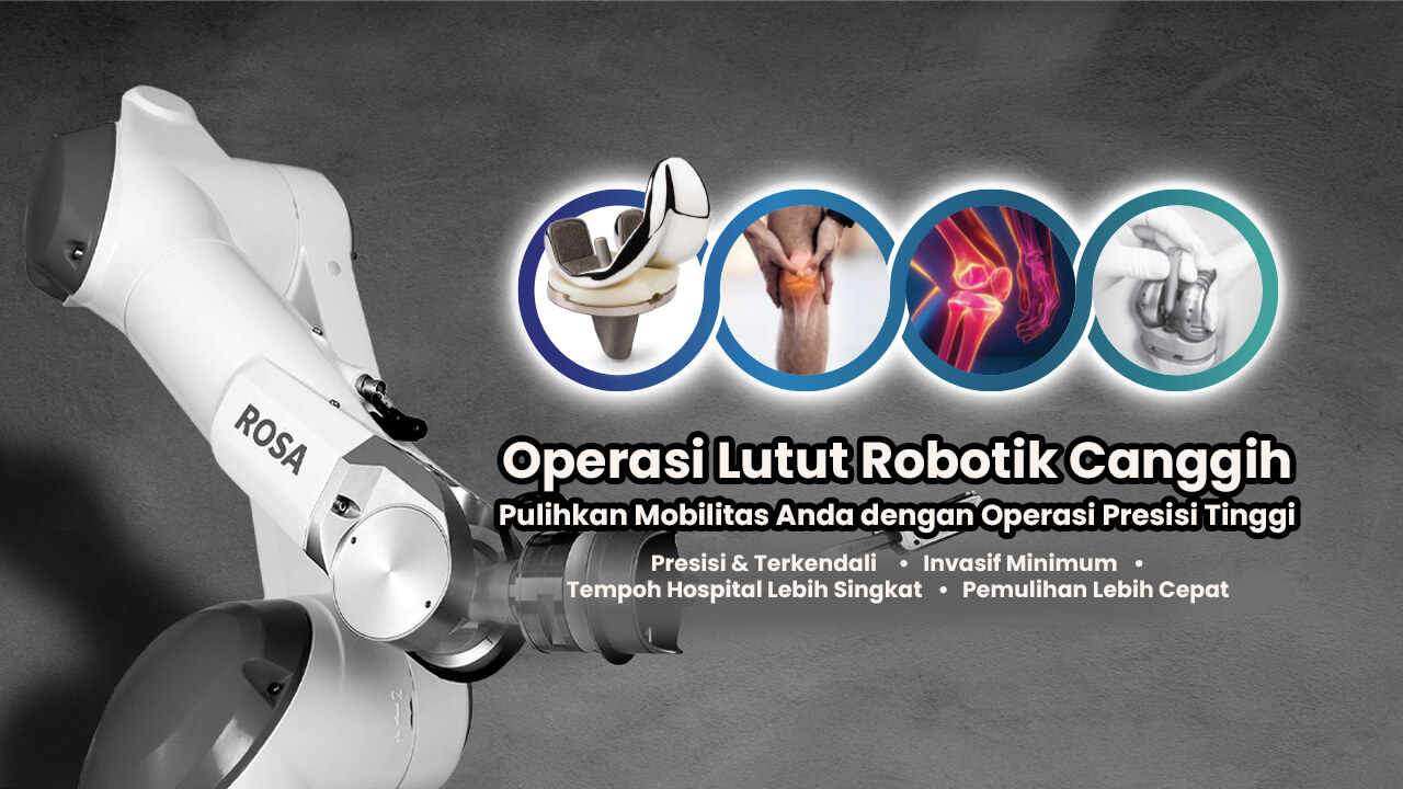 Advanced Robotic Knee Surgery